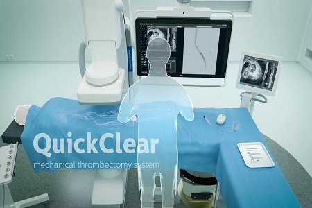 QuickClear Mechanical Thrombectomy System - TechSci Research